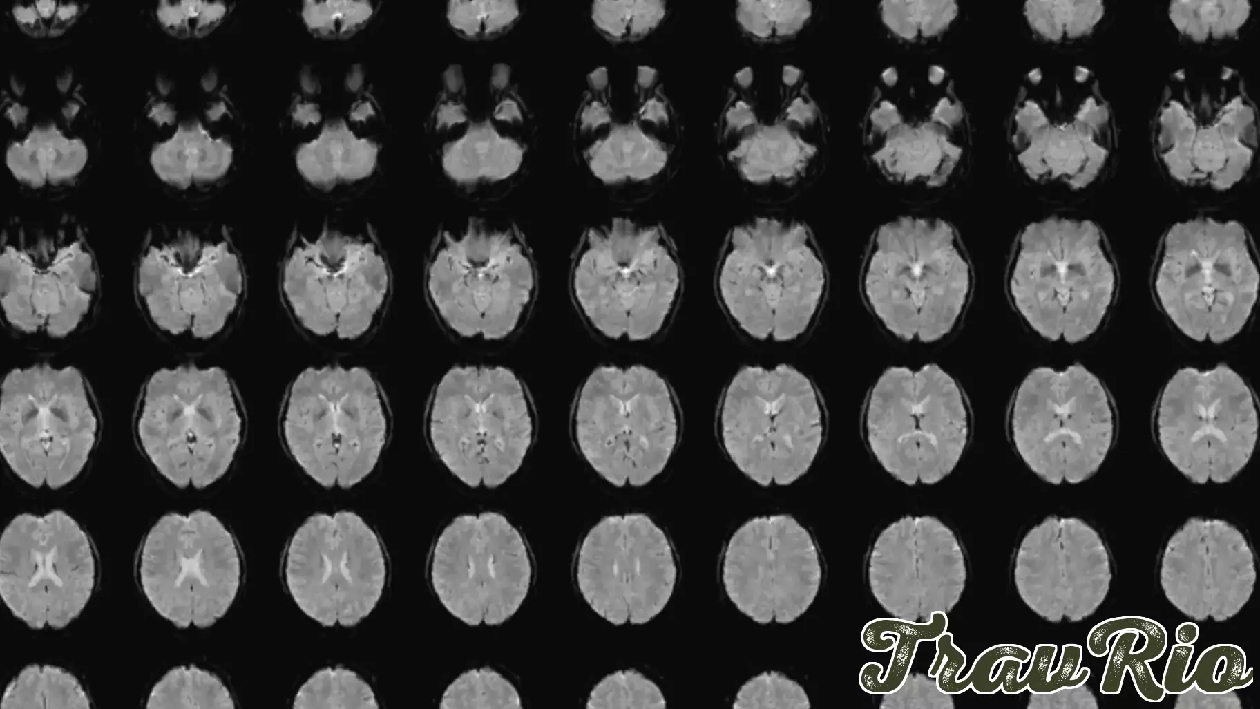 Revolutionary Technology Converts Mental Images into Descriptive Text