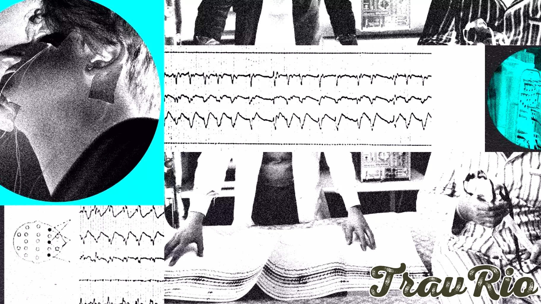 Technology Is Reshaping Sleep Apnea Treatment