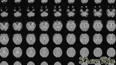 Revolutionary Technology Converts Mental Images into Descriptive Text